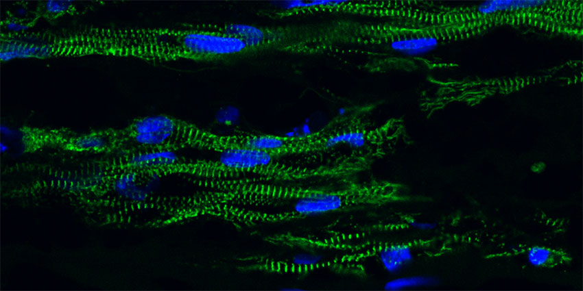 irregular blue dots on a skeleton-like framework
