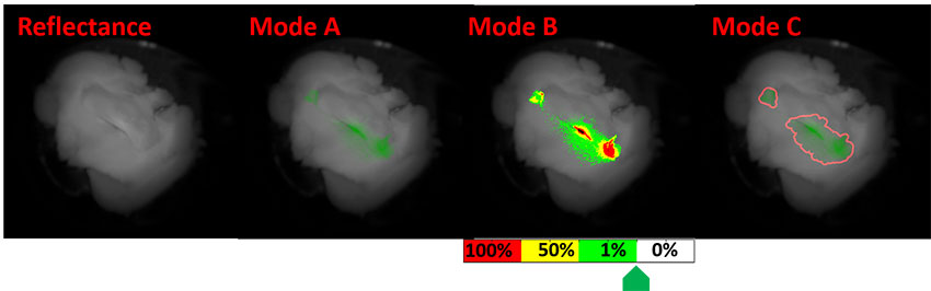 full-color reflectance image shown in grayscale on the left and modes that highlight cancer cells on the right