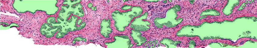 An example of imaging in which prostate glands have been automatically segmented through an ML-based algorithm.