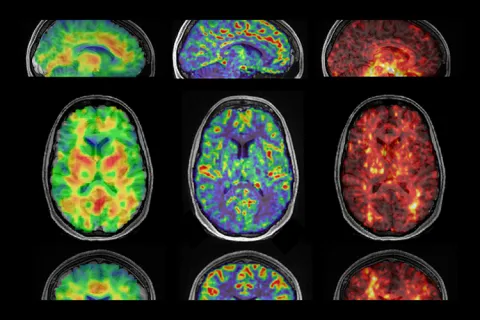 A grid of nine colorful brain scans in varying hues of green, blue, purple, and red on a black background