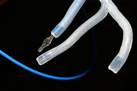 A catheter routed through a model of arteries