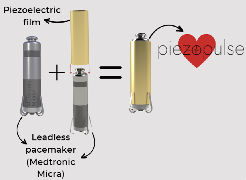 A graphic shows how the gold-colored piezoelectric film sleeve fits over the Medtronic Micra leadless pacemaker