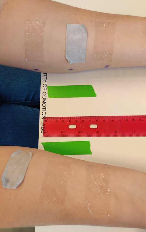 A study participant's arms are shown with medical tape on both sides.