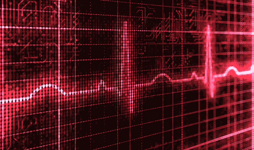 graphic of heartbeat monitoring display