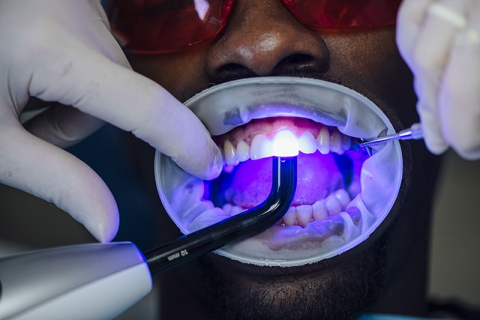 A person's open mouth with two gloved hands and a flashlight-like device probing at his teeth