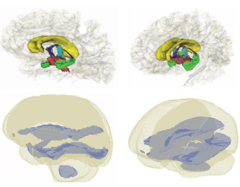 ILlustration of the brain