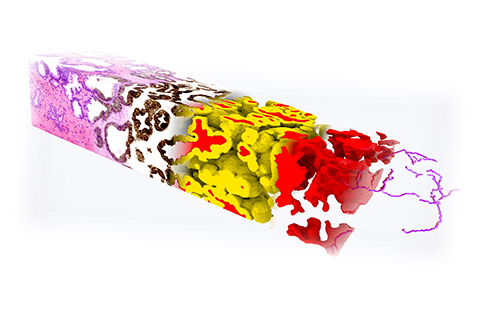 A 3D pathology dataset of a prostate biopsy stained with a fluorescent analogue of H&E.