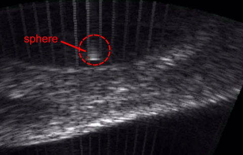 ultrasound image labeled "sphere" as an indication of where the small glass sphere is inside a bladder