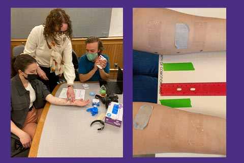 Collage of ThermoTape trials. Left: Two researchers testing ThermoTape on a participant. Right: Close-up of study participant's arms with medical tape on both sides.